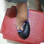 Insole-fitted-with-filler-for-partial-foot-amputation-2-150x150 Insole-fitted-with-filler-for-partial-foot-amputation-2-150x150